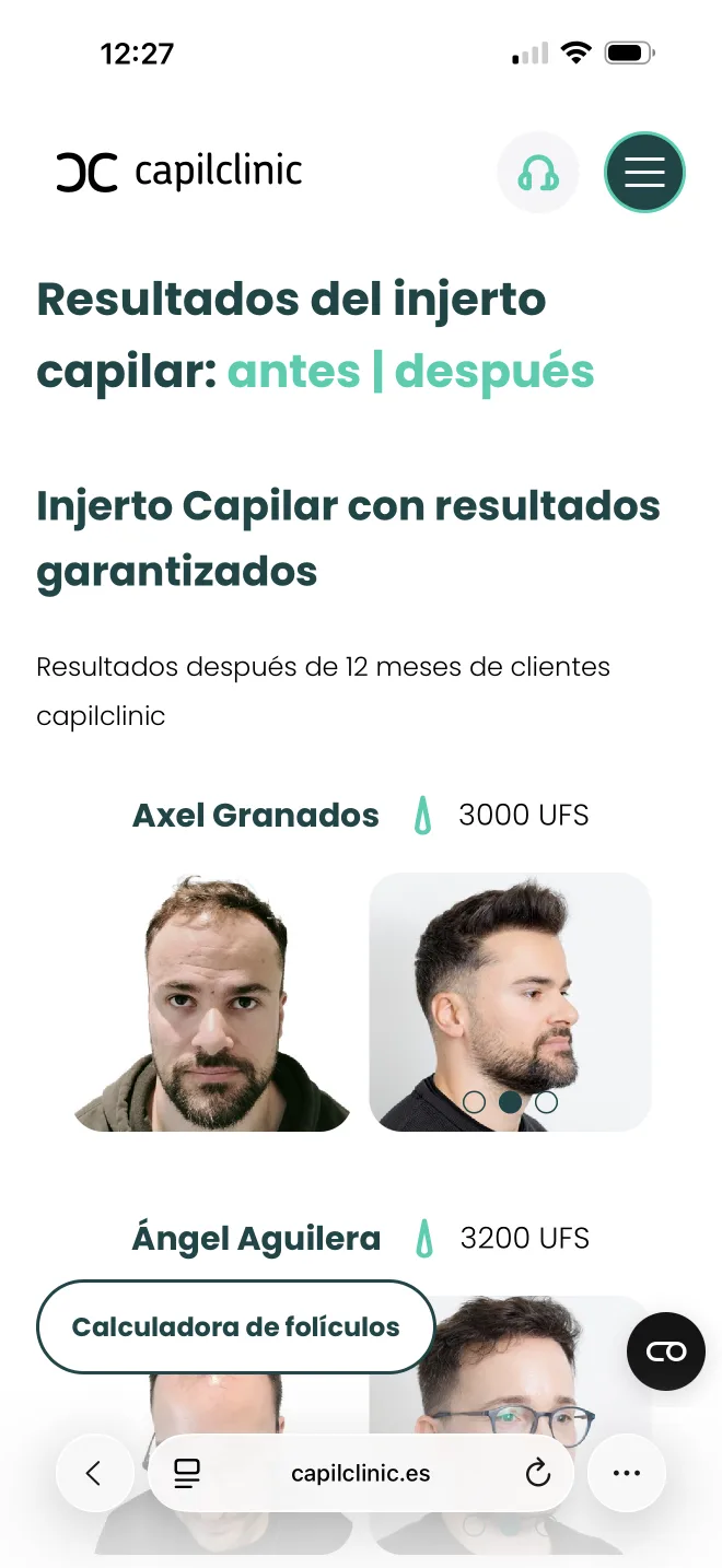 Resultados antes y después en mobile